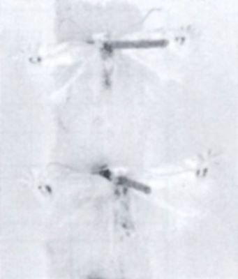 Cermiostoma sessiliella (Chretien)