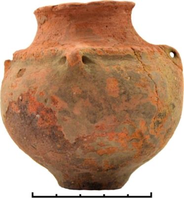 pyxis; Vas