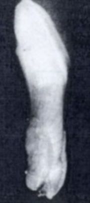 melc; Milax gracilis valachicus (Grossu et Lupu, 1961)