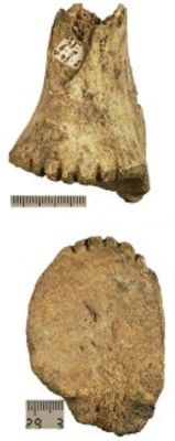Netezitor de os / Omoplat crestat