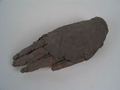 organ mumificat; mâna dreaptă mumificată